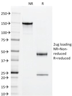 CD55/DAF Antibody (143-30), Novus Biologicals 0.2mg; Unlabeled:Antibodies,